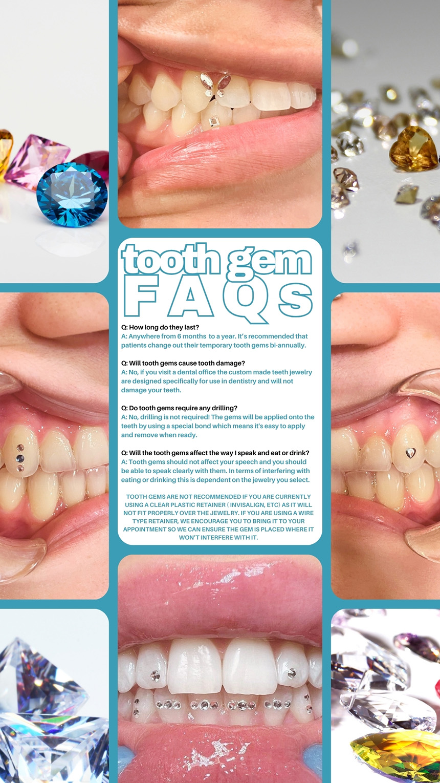 tooth gems faq graphic
